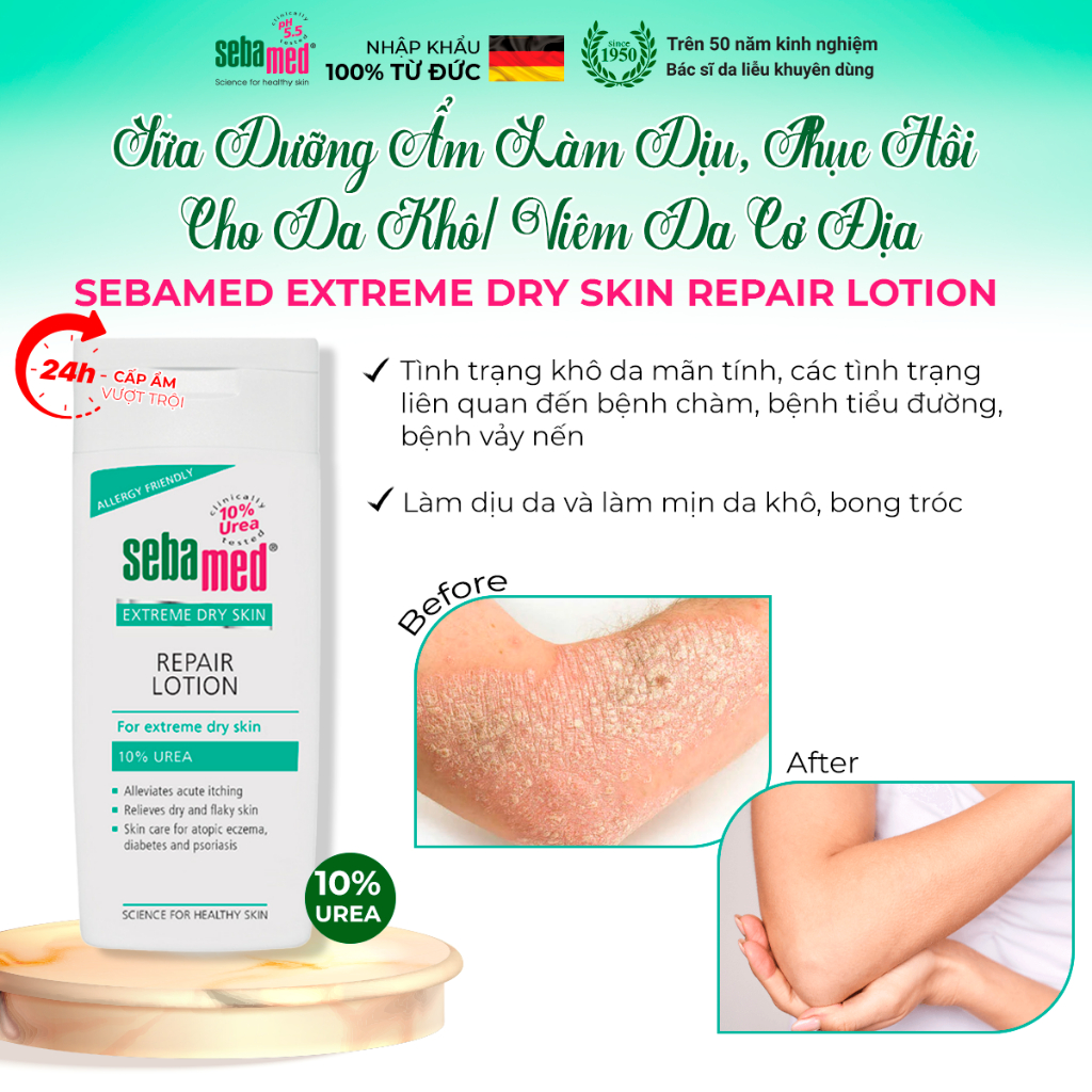 Ảnh Sữa dưỡng thể dưỡng ẩm, giảm khô ngứa, bong tróc cho da khô viêm cơ địa Sebamed Dry Lotion 200ml 2