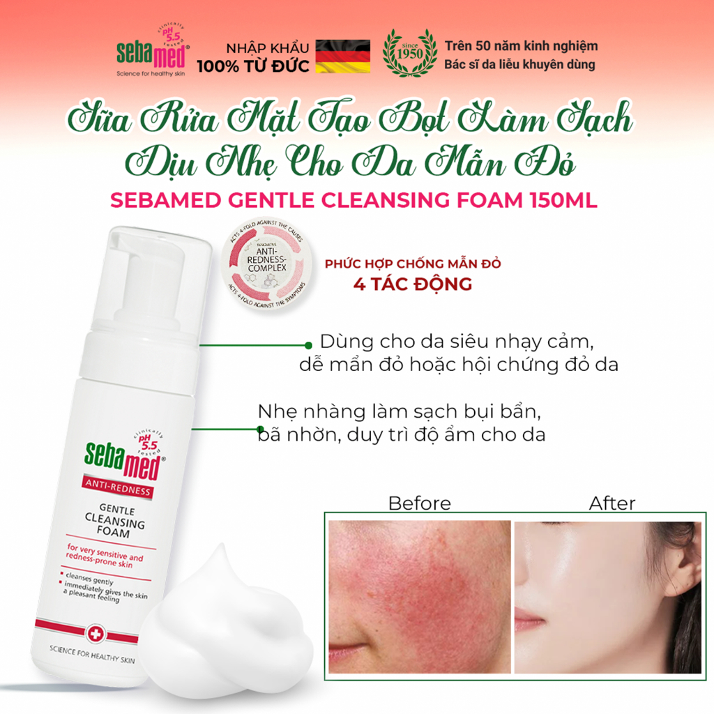 Ảnh Sữa rửa mặt cho da siêu nhạy cảm da dễ mẫn đỏ Sebamed Anti-Redness Gentle Cleansing Foam 150ml 2