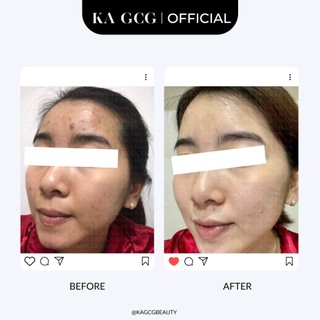 [Sale cận date] Tinh chất dưỡng da FOREVER YOUTH chống lão hóa giúp cải thiện nếp nhăn 30ML KA GCG