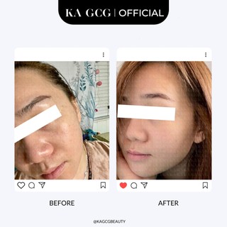 [Sale cận date] Tinh chất dưỡng da FOREVER YOUTH chống lão hóa giúp cải thiện nếp nhăn 30ML KA GCG
