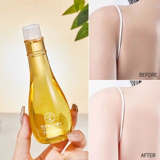 Tinh Dầu Rạn Da ÔLiu Xroland.Giảm Rạn Da Mờ Sẹo  Thích Hợp Cho Mẹ Bầu