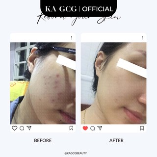 [Sale cận date] Kem dưỡng DAY CREAM bảo vệ da ban ngày giúp làm sáng và cấp ẩm 50ml KA GCG