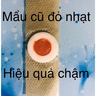 Sét 15 Miếng dán mụn cóc hiệu quả lột mụn nhanh chóng