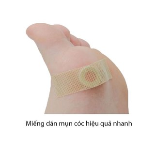 Sét 15 Miếng dán mụn cóc hiệu quả lột mụn nhanh chóng