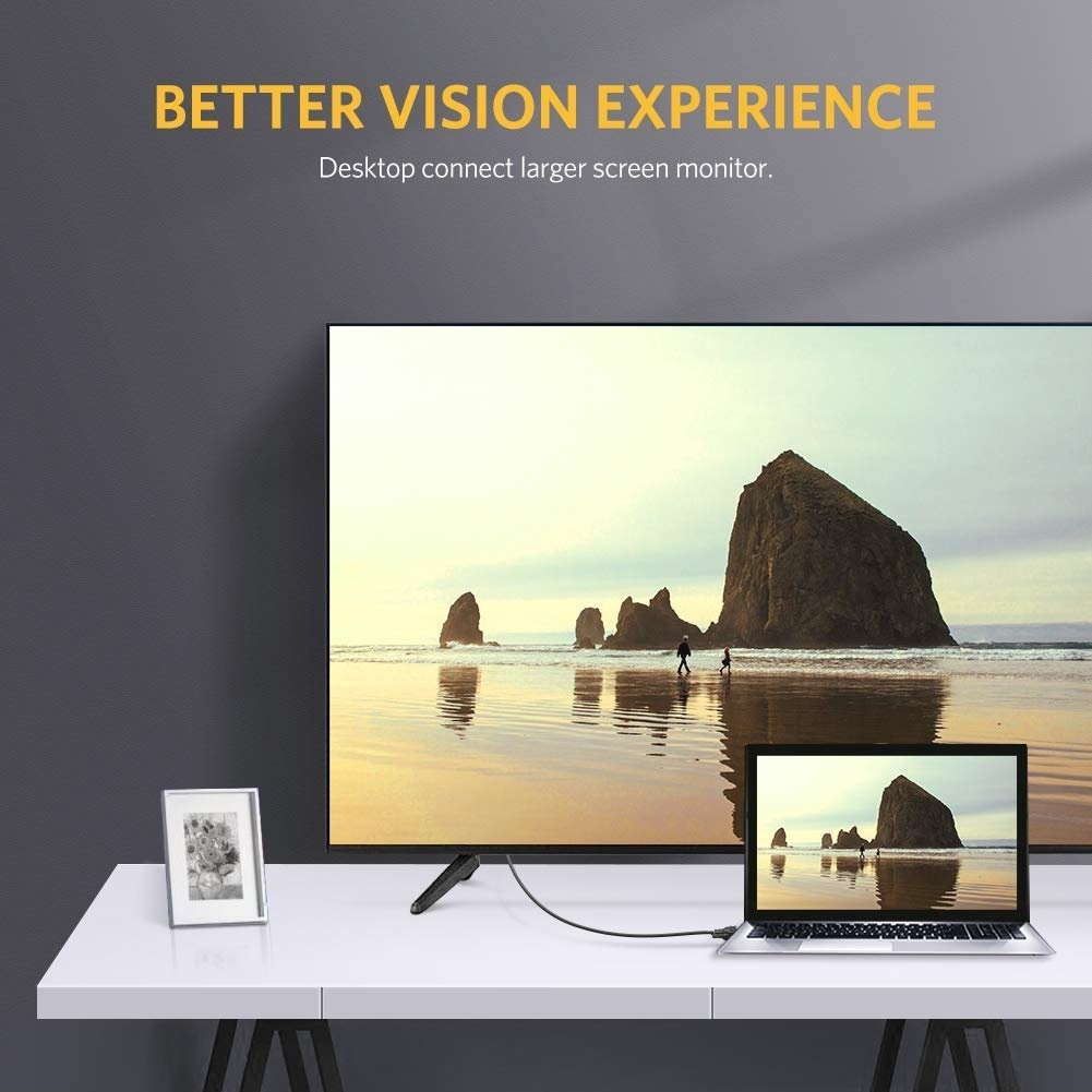 Cáp DVI Chất Lượng 1.5m – Đảm Bảo Truyền Tín Hiệu Ổn Định và Hình Ảnh Full HD 1080P