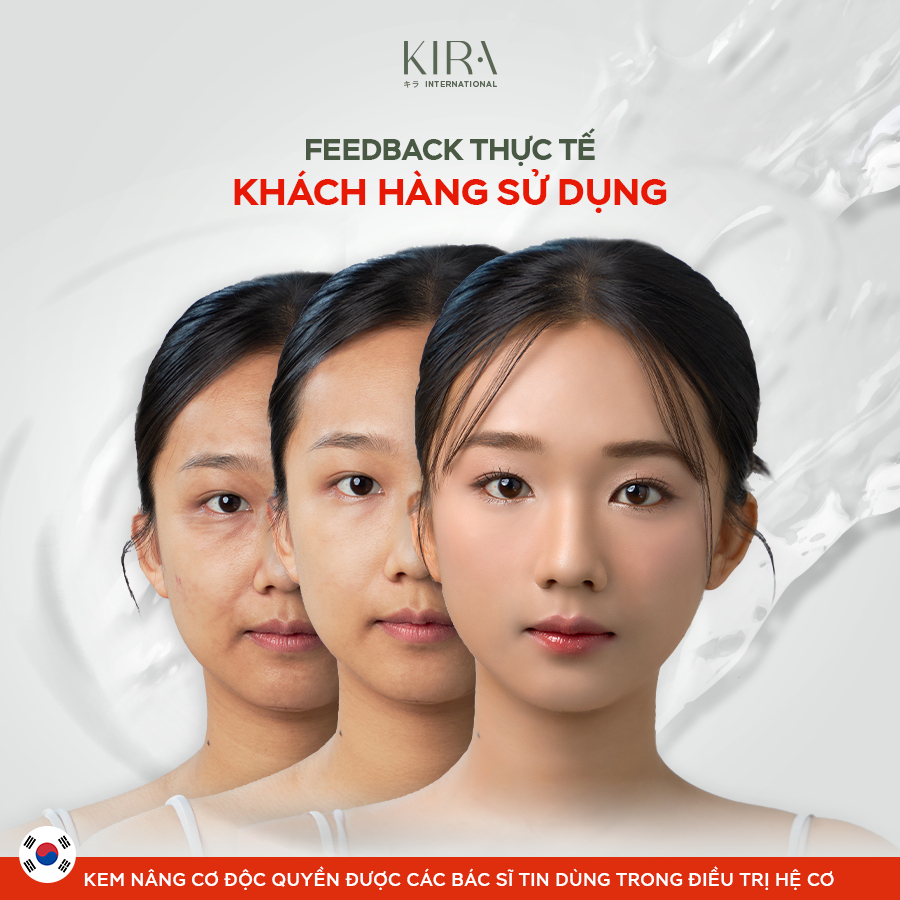 Kem Nâng Cơ Kira Joint Care Complex Cream - Giảm Nếp Nhăn, Tăng sinh Collagen 48g