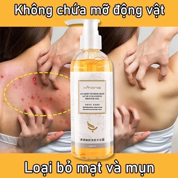 Sữa tắm chống ve Sữa tắm loại bỏ mụn sữa tắm trắng da 260ml giúp giải quyết tình trạng da khô ngứa kháng khuẩn kh