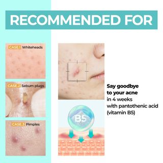 Kem dưỡng/Serum/Toner/ Toner Pad làm dịu da NUMBUZIN No.1 Pantothenic B5 Active Soothing