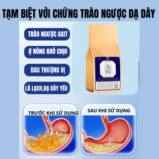 [Trào ngược,ợ hơi] Trà dạ dày Fengcha giúp giảm ợ nóng,ợ hơi, trào ngược, đau thượng vị bịch 30 lọc