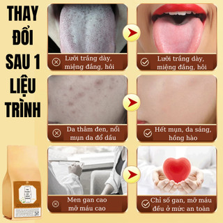 [Giải nóng trong] Trà thanh lọc cơ thể, giảm nóng trong Fengcha thanh nhiệt, thải độc gan , dạ dày, thận bịch 30 gói lọc