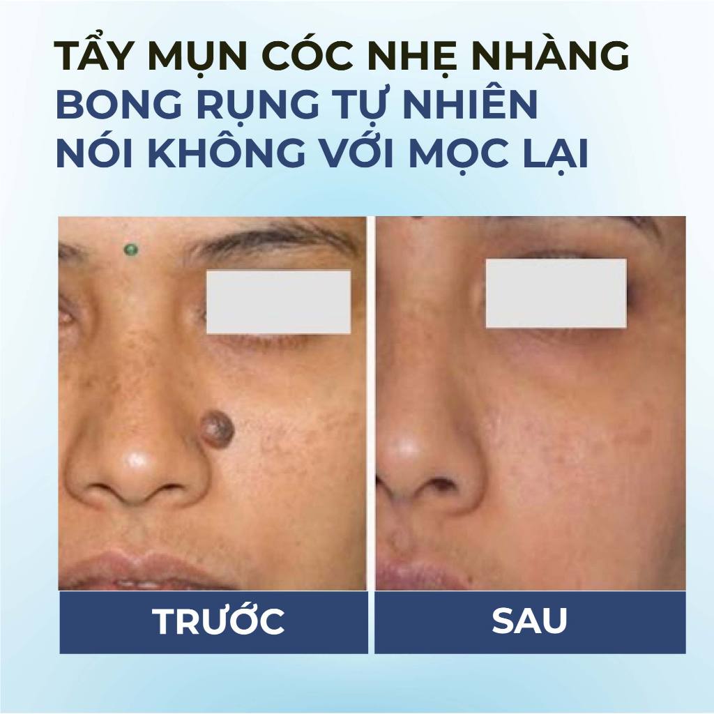 Serum chấm bôi mụn cóc mụn thịt vết chai sần Bellena Skin Smooth Serum