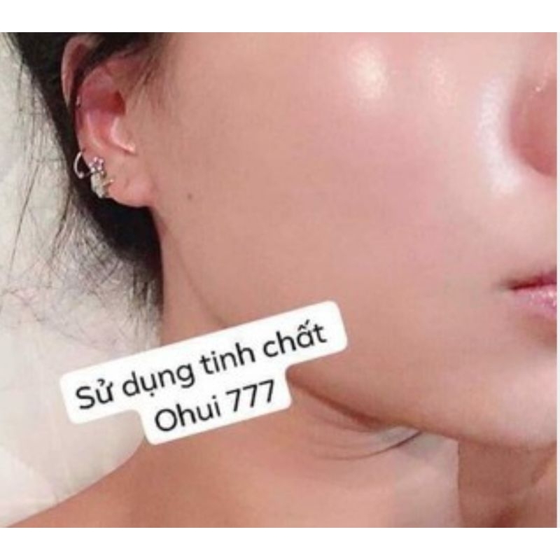 Combo 10 gói Tinh Chất Phục Hồi Da Ohui Miracle Moisture Ampoule 777
