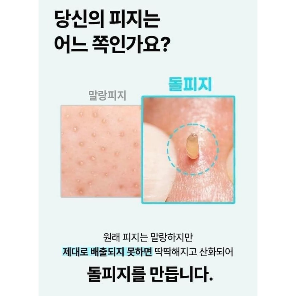 Tinh Chất Ủ Mụn Đầu Đen, Làm Mềm Sợi Bã Nhờn Ilso Sebum Super 150ml Chính Hãng + Cây Nặn Mụn