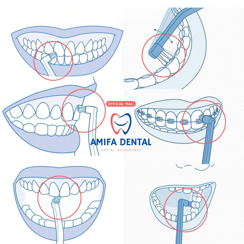 Bàn Chải Chỉnh Nha Đầu Nhỏ, Bàn Chải Chuyên Dụng Cho Người Niềng Răng, Bàn Chải Lông Mềm