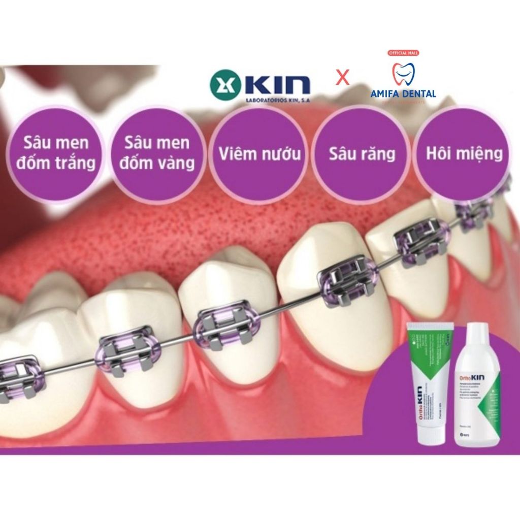 Kem Đánh Răng Cho Chỉnh Nha, Răng Niềng OrthoKin 75ml - Chính Hãng KIN
