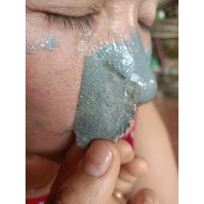 Lột mụn đầu đen Dr Acne chính hãng