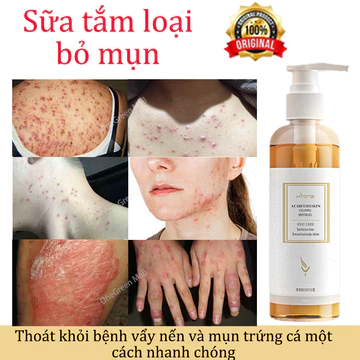 Sữa tắm loại bỏ mụn Sữa tắm chống ve sữa tắm làm trắng da Sữa tắm viêm nang lông giảm mụn lưng giảm ngứa 260ml