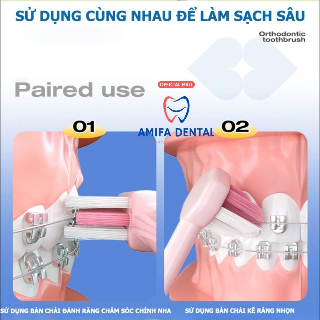 Bàn Chải Chỉnh Nha Chữ U, Bàn Chải Chuyên Dụng Cho Người Niềng Răng, Bàn Chải Niềng Răng