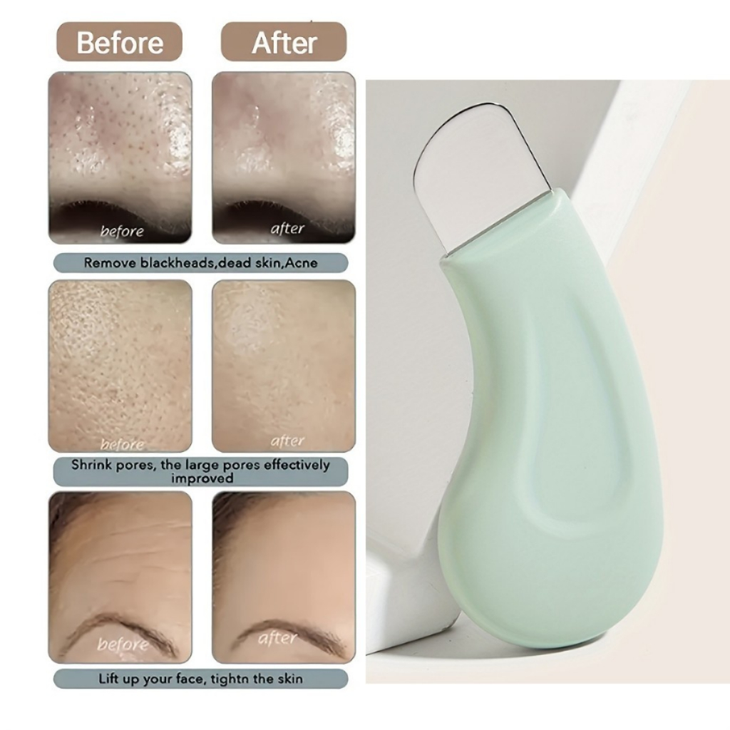 Ảnh Cây Nặn Mụn Đầu Đen Chuyên Dụng Ilso Deep Clean Master 1