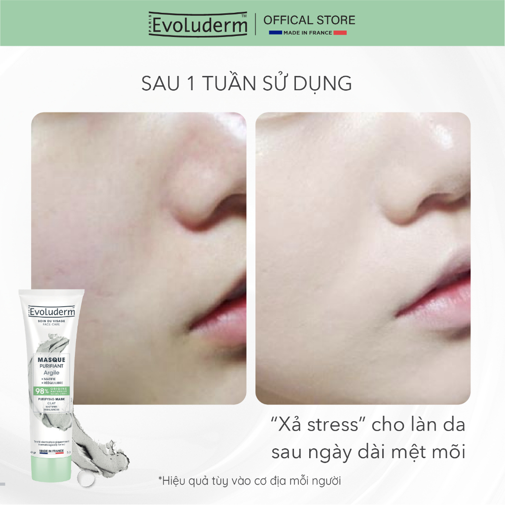 [cận date] Mặt nạ cung cấp dưỡng chất cho da Evoluderm 150ml (Nhiều phân loại)