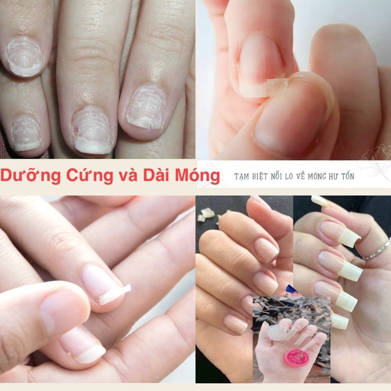 Dưỡng Móng Cứng [Combo 2 Hũ] Phục Hồi Móng Tay Chân Chắc Khỏe, Nhanh Dài, Bóng Hũ 8gr Date 2024
