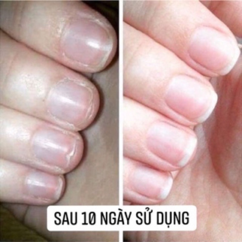 Dưỡng Móng Cứng [Combo 2 Hũ] Phục Hồi Móng Tay Chân Chắc Khỏe, Nhanh Dài, Bóng Hũ 8gr Date 2024
