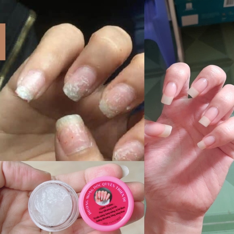 Dưỡng Móng Cứng [Combo 2 Hũ] Phục Hồi Móng Tay Chân Chắc Khỏe, Nhanh Dài, Bóng Hũ 8gr Date 2024