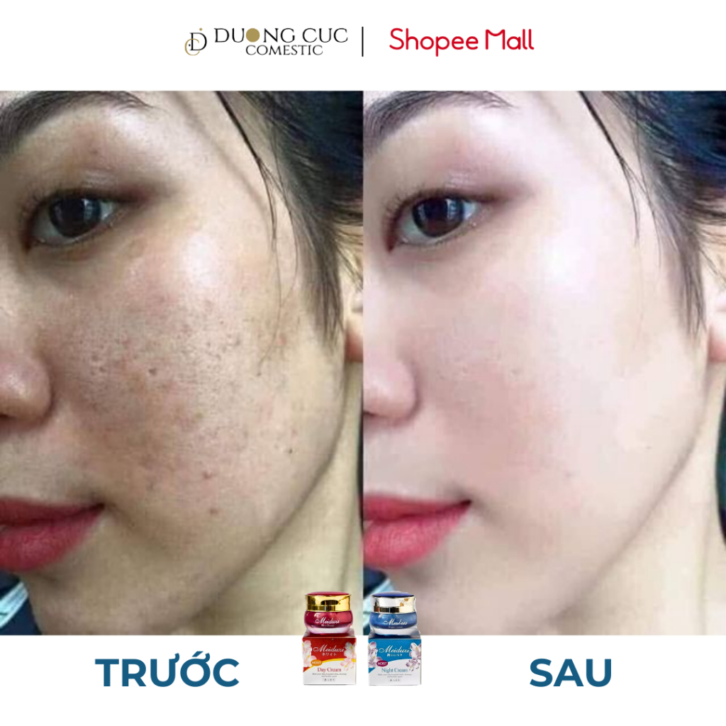 Ưu điểm Combo Dưỡng Trắng Meiduzi DC18