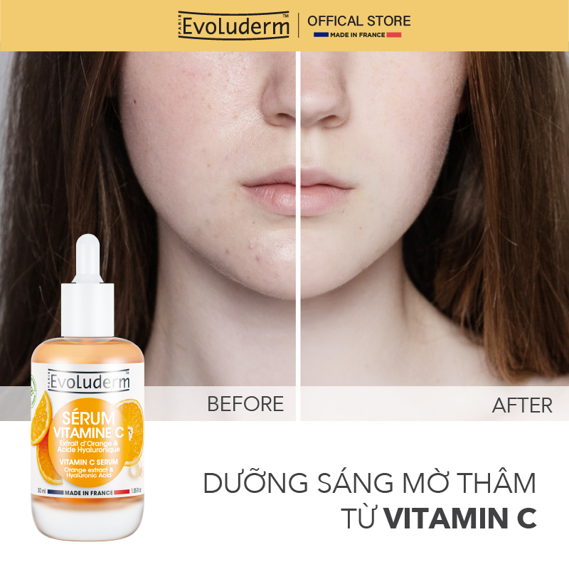 Tinh chất EVOLUDERM VITAMIN C SERUM giúp sáng da mờ thâm, dưỡng da mịn màng tươi sáng 30ml