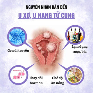 Trà tiêu u xơ tử, giảm u nang tử cung, hỗ trợ viiiêm nhiễm phụ khoa phụ nữ Fengcha bịch 30 gói lọc