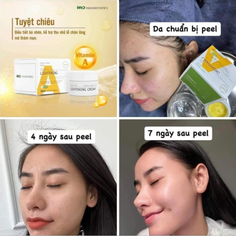 Peel A Lightening Inno giúp da mềm mịn, căng bóng, trắng sáng