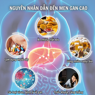 [Hạ men gan] Trà hạ men gan Fengcha thải độc gan, hạn men gan, mỡ gan, ngừa xơ gan bịch 30 gói lọc