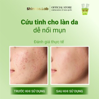 SERUM DƯỠNG ẨM GIẢM MỤN DỊU DA AHA/BHA/PHA CENTELLA 3%