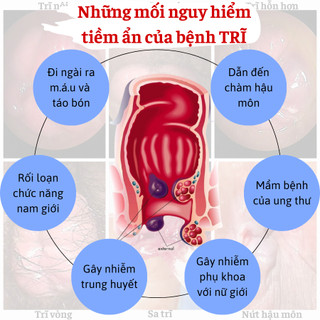 [Đau nhức trĩ] Kem bôi trĩ cho người trĩ ngoại lâu năm, trĩ nội kinh niên hũ 10gram