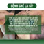 Kem bôi da ghẻ lở ngứa nấm Fengcha cho người bị ghẻ ngứa lâu năm bôi nhiều loại rồi mà chưa khỏi hũ 10gram