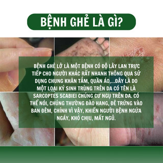 [Ghẻ lở] Kem bôi da ghẻ lở ngứa nấm Fengcha cho người bị ghẻ ngứa lâu năm bôi nhiều loại rồi mà chưa khỏi hũ 10gram