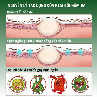 [Ghẻ lở] Kem bôi da ghẻ lở ngứa nấm Fengcha cho người bị ghẻ ngứa lâu năm bôi nhiều loại rồi mà chưa khỏi hũ 10gram