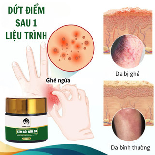 [Ghẻ lở] Kem bôi da ghẻ lở ngứa nấm Fengcha cho người bị ghẻ ngứa lâu năm bôi nhiều loại rồi mà chưa khỏi hũ 10gram