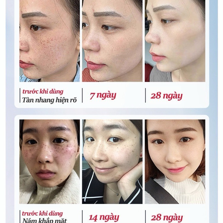Kem Dưỡng Trắng Mờ Nám, Tàn Nhang HIISEES da sáng rạng rỡ tuýp 20g hàng chính hãng nội địa Trung
