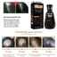 Combo Dầu gội + Serum mọc tóc giảm gàu DHT,Dầu gội DHT kích thích mọc tóc, giảm gàu, nấm ngứa, bảo vê nang tóc chắc khoẻ