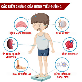 [Tiểu đường lâu năm] Trà hạ đường huyết Fengcha cho người mắc tiểu đường lâu năm, người chớm bị , ngừa biến chứng