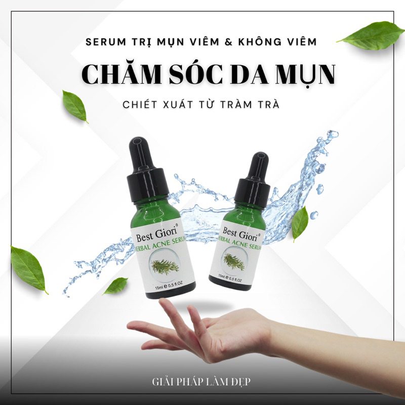 Serum giảm mụn thâm và làm dịu da, kiểm soát dầu BEST GIORI 15ml
