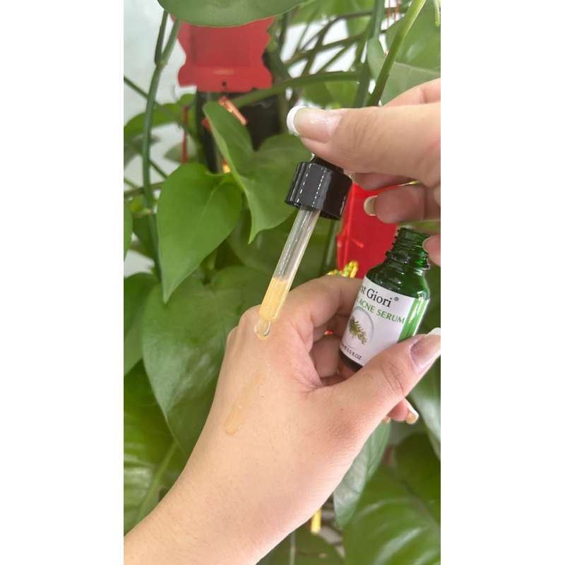 Serum giảm mụn thâm và làm dịu da, kiểm soát dầu BEST GIORI 15ml