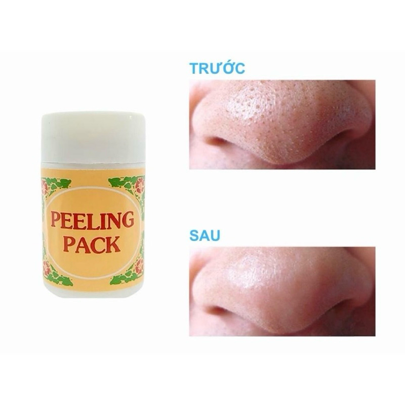 Kem Lột Mụn Peeling Pack 25G, 60G Lột Mụn Đầu Đen, Mụn Cám.
