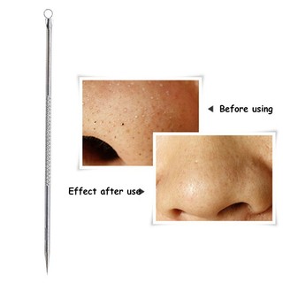 COMBO 10 Cây Nặn Mụn Cao Cấp, Que Nặn Mụn 2 Đầu Bằng Inox Không Gỉ Dùng Trong Spa Tiện Dụng 88830