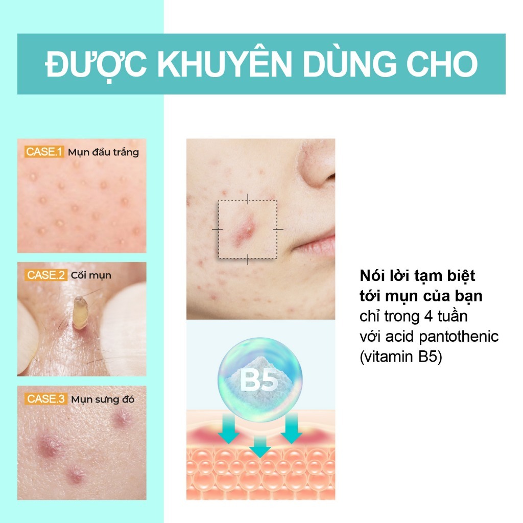 Ảnh Kem Dưỡng ẩm, Giảm Dầu Mụn Numbuzin No.1 Pantothenic B5 Active Soothing Cream 80ml 2
