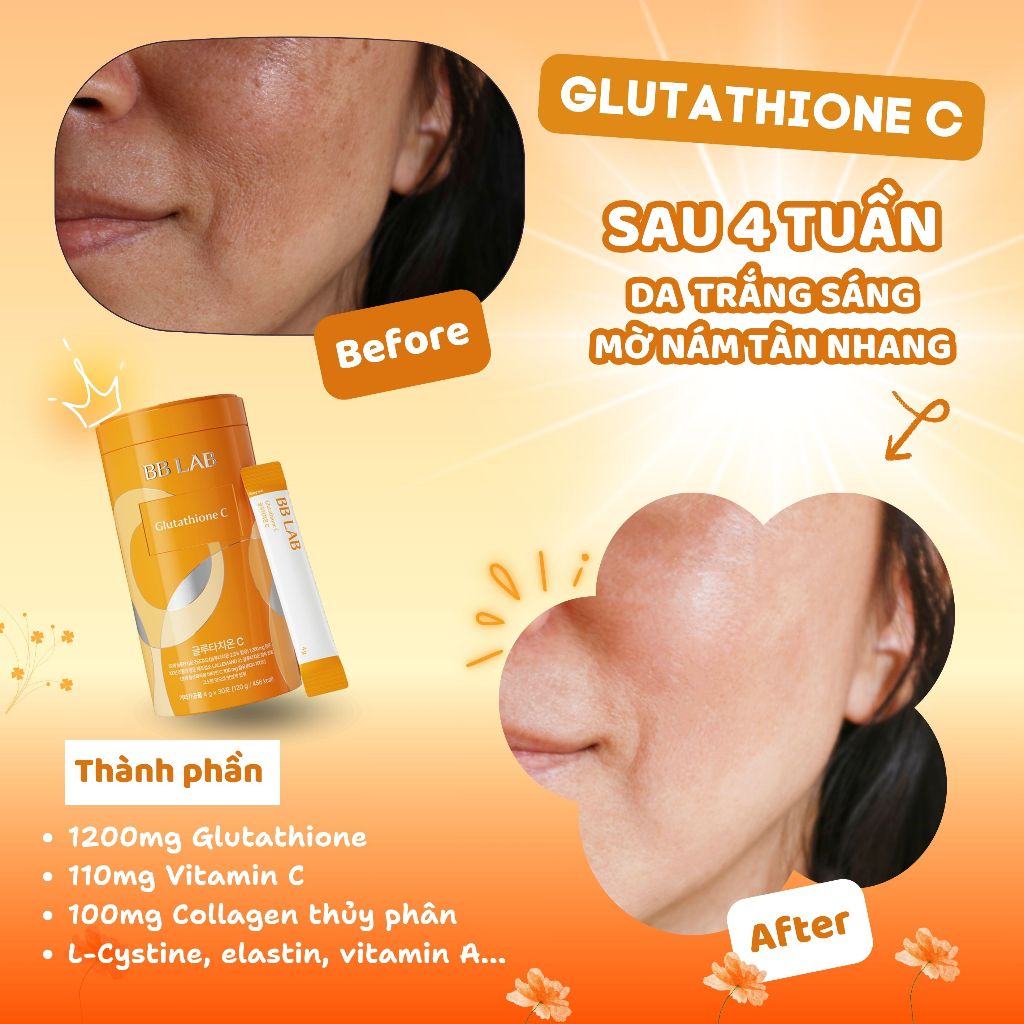 Ảnh Bột uống BB LAB Glutathione 1200mg và Vitamin C 110mg Làm Trắng Da, Mờ Nám, Giảm Thâm Mụn Hộp /30 Gói 2