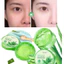 Gel Nha Đam Dưỡng Ẩm, Làm Dịu Da, Ngăn Ngừa Mụn Và Se Khít Lỗ Chân Lông