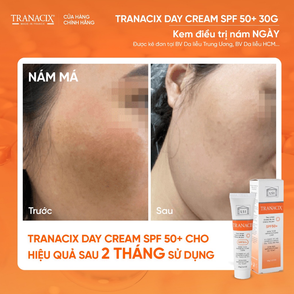 Kem nám và chống nắngTranacix Cream Day SPF 50+ 30G ngừa nám và bảo vệ da hằng ngày