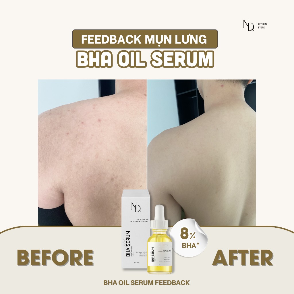 COMBO Kem Xóa Thâm Be Charm 100ml + BHA Serum 8% 15ml Giảm Mụn BHA ND